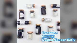 Exosome Clinical: Cancer Detection Breakthrough