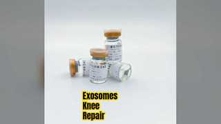 Exosomes Knee Injection Cartilage Repair