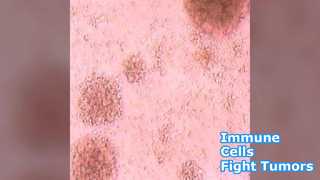 Immune Cells Fight Tumors Improve Health