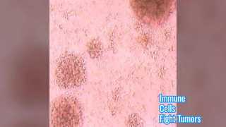Immune Cells Fight Tumors & Boost Health
